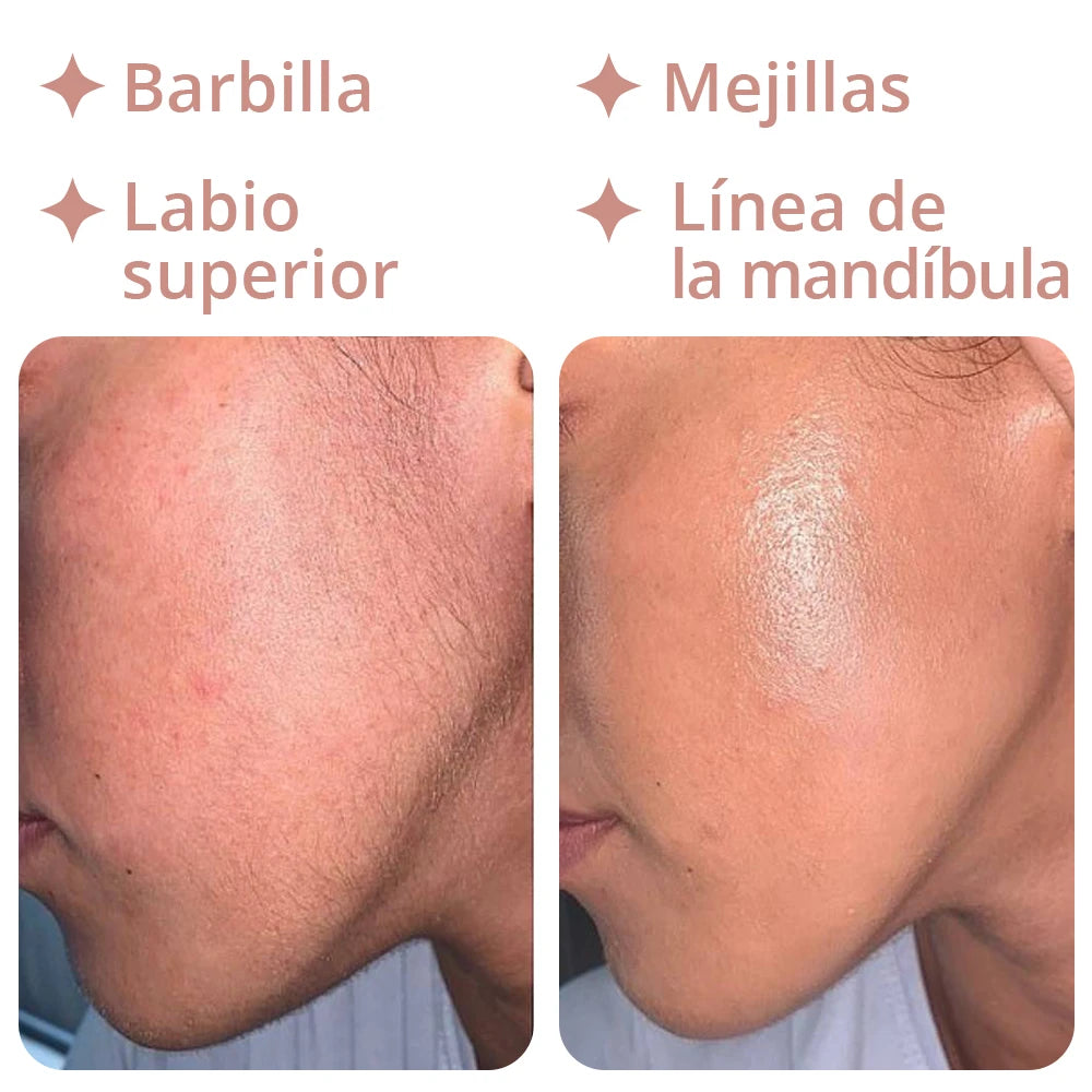 Epilator 18k - Depiladora facial